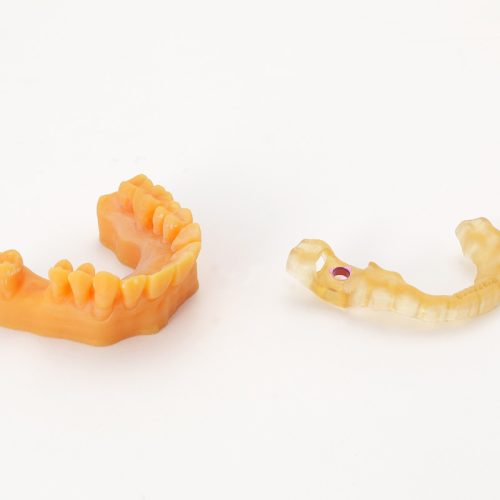 RAYDENT_Studio_SG_DM_etc_Resin_Output15_180302